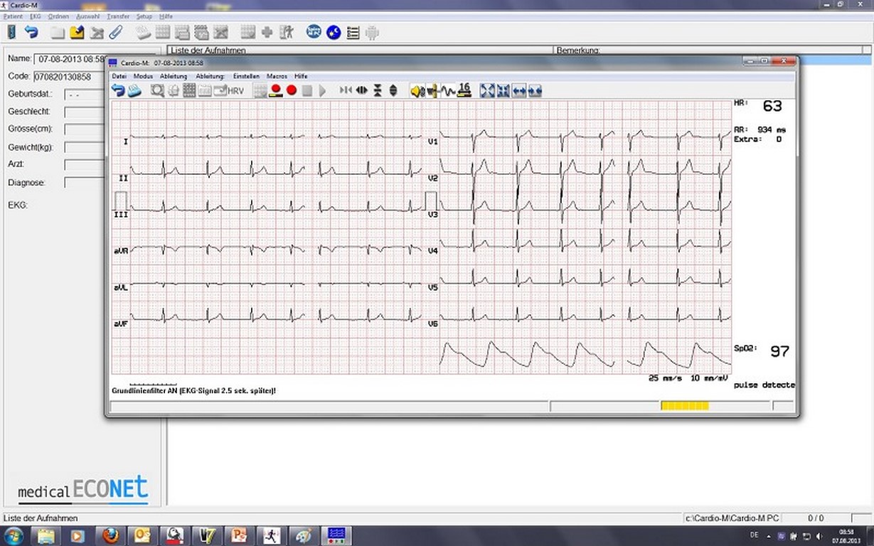 medical ECONET Cardio M-PC USB DDC Software / Auswertungssoftware