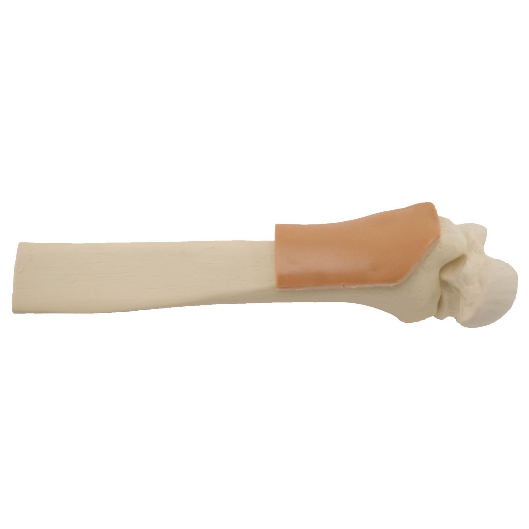 Arrow® EZ-IO® Trainingsknochen / Übungsknochen Distal Tibia Erwachsene